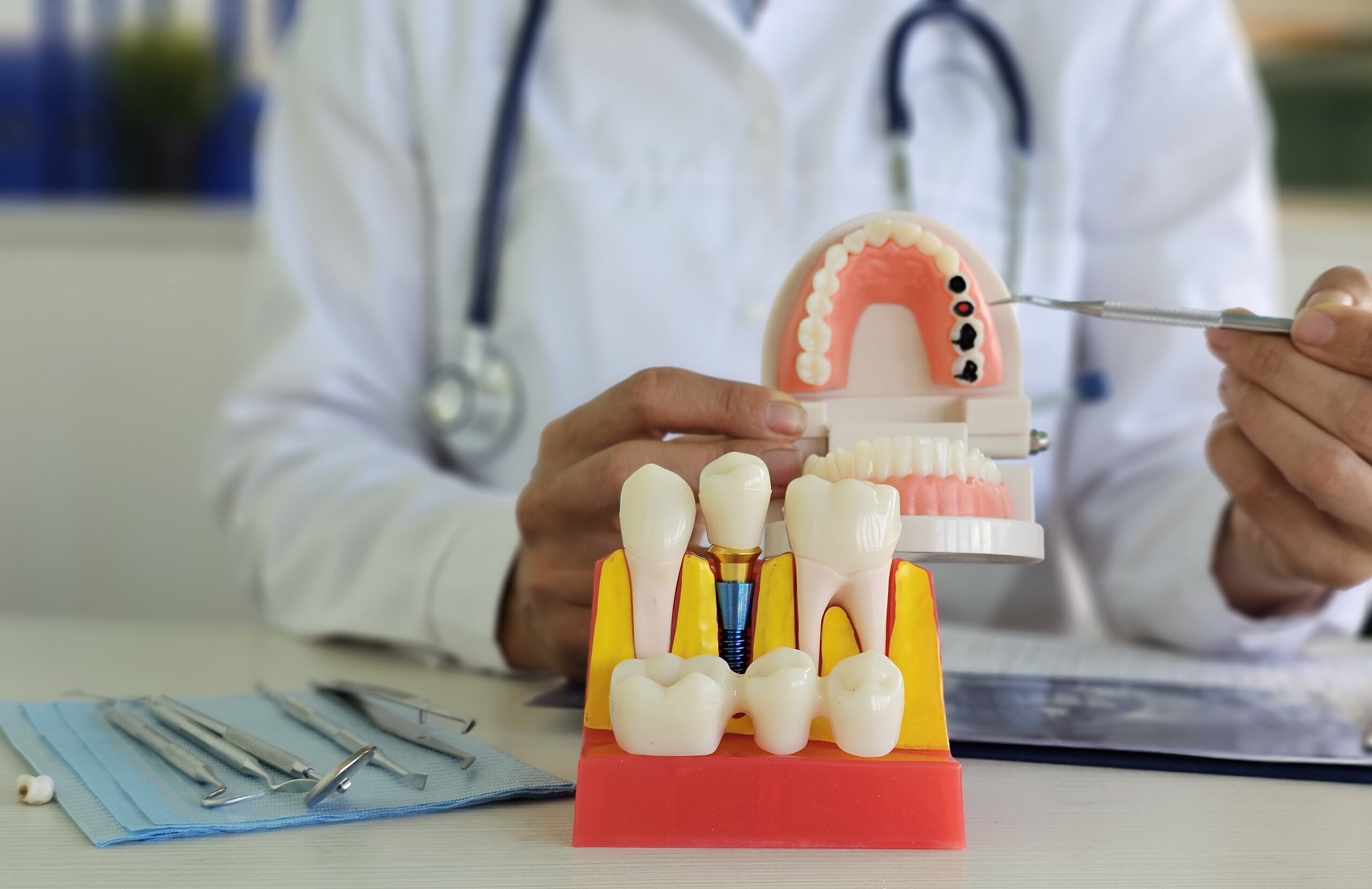 A dentist demonstrating the cost of dental implants
