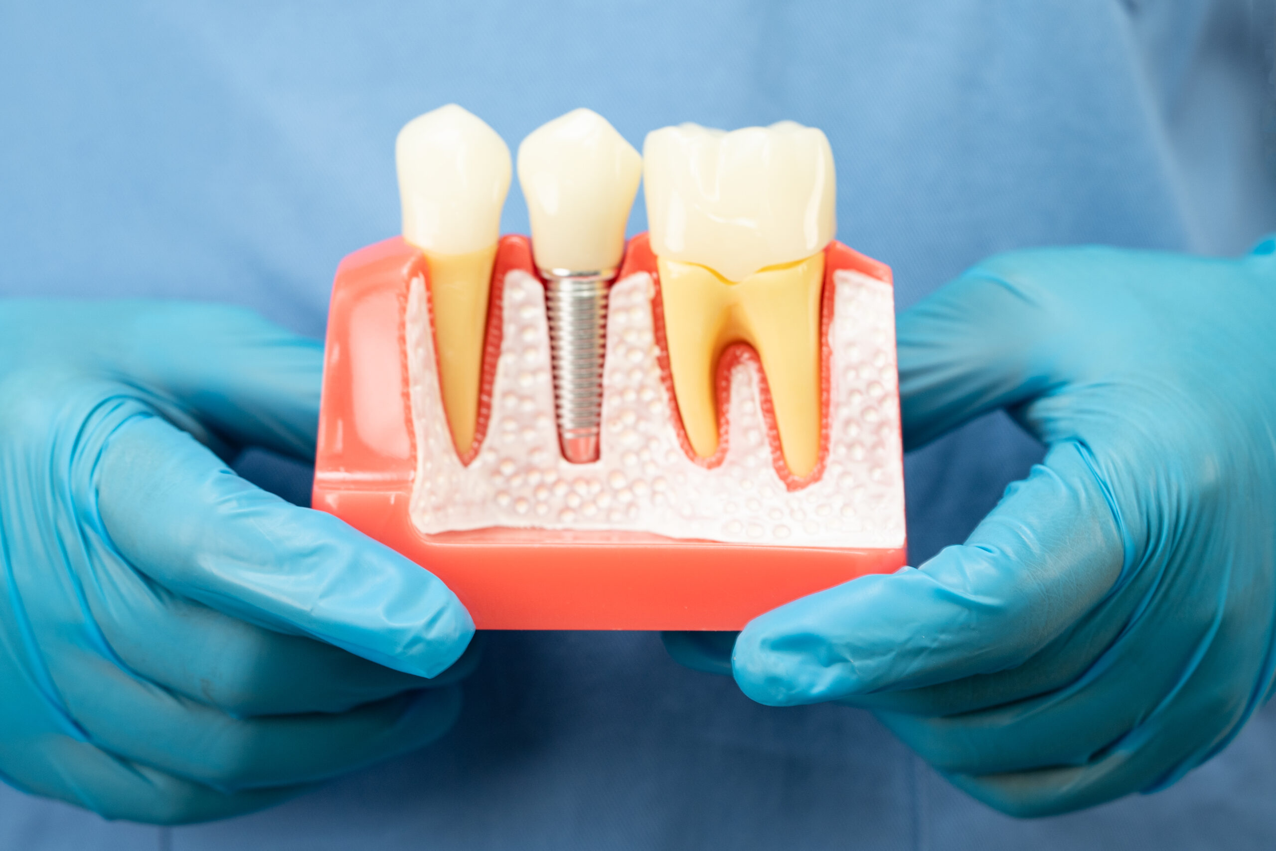 A dentist explaining a simple and stress-free process for all-on-X dental implants