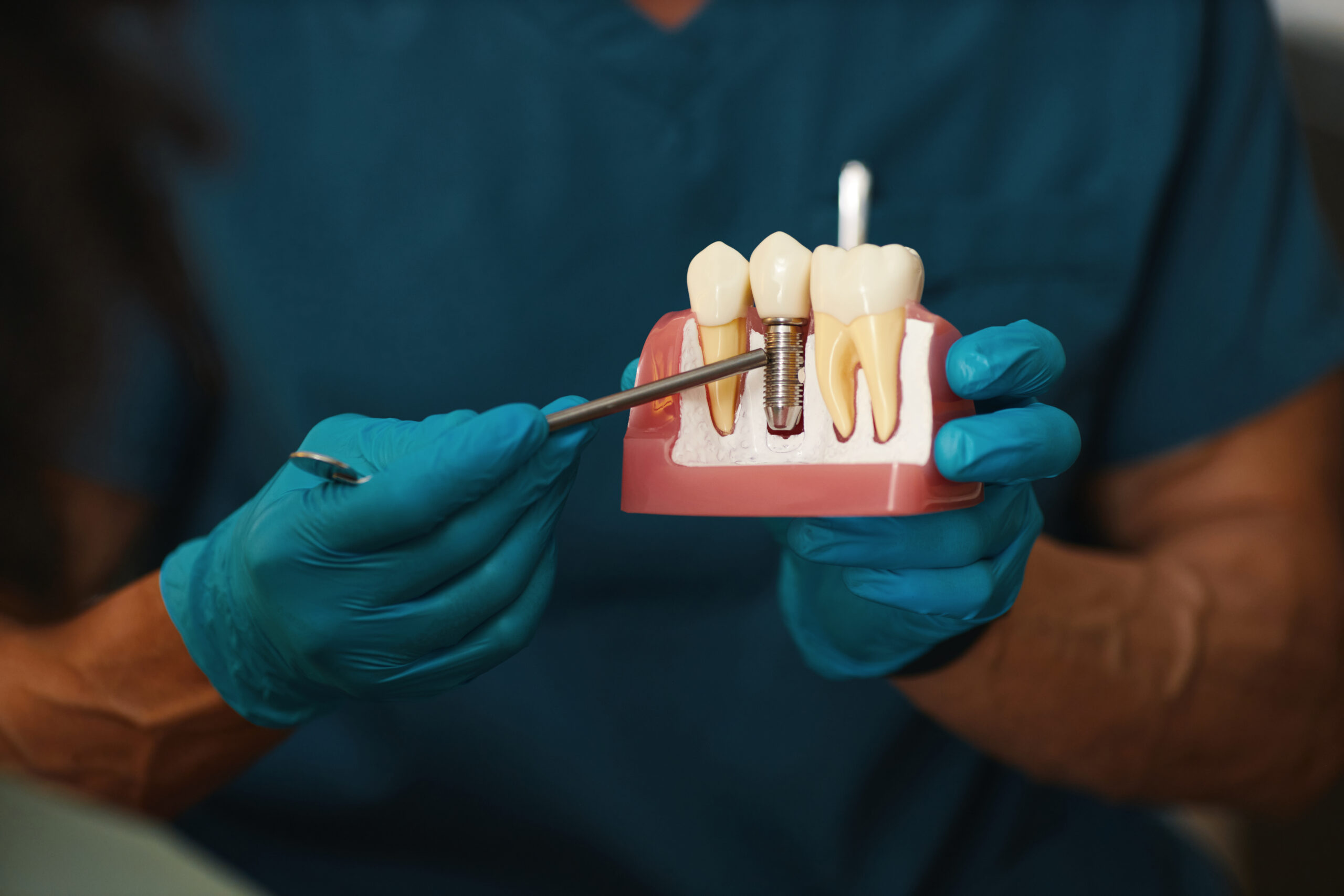 A dentist presents a smart option for patients with bone loss seeking all-on-x dental implants